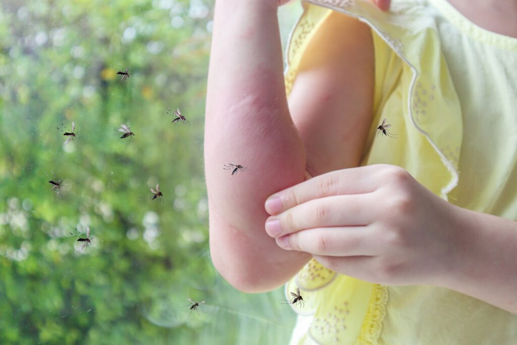 girl surrounded by mosquitos with mosquitos bites