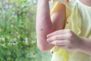 girl surrounded by mosquitos with mosquitos bites